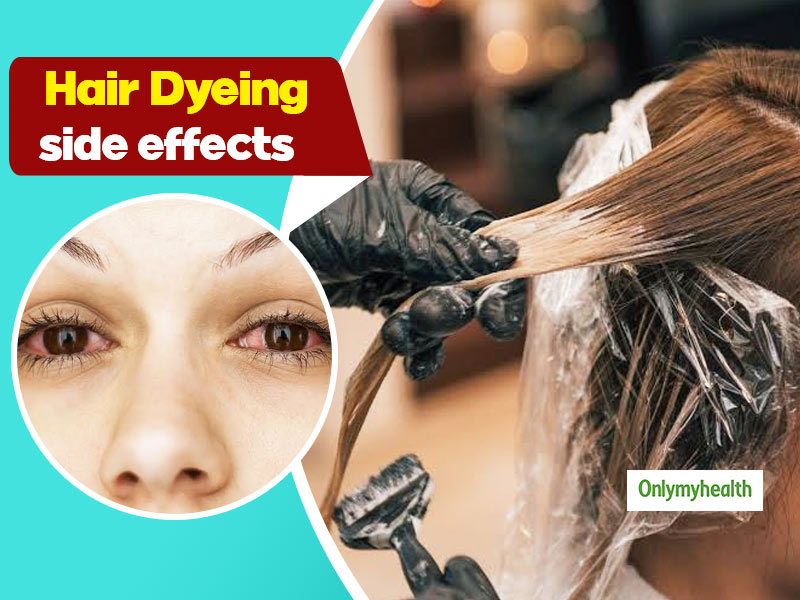 Check Out These Side Effects Of Applying Hair Dyes